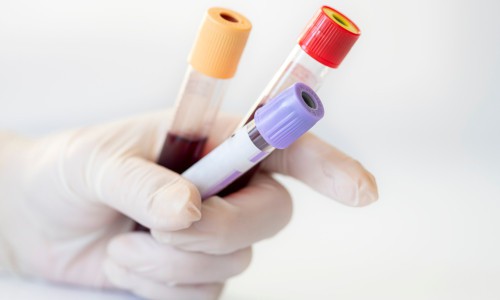Printed acne blood test results on a kitchen counter next to an at-home collection kit
