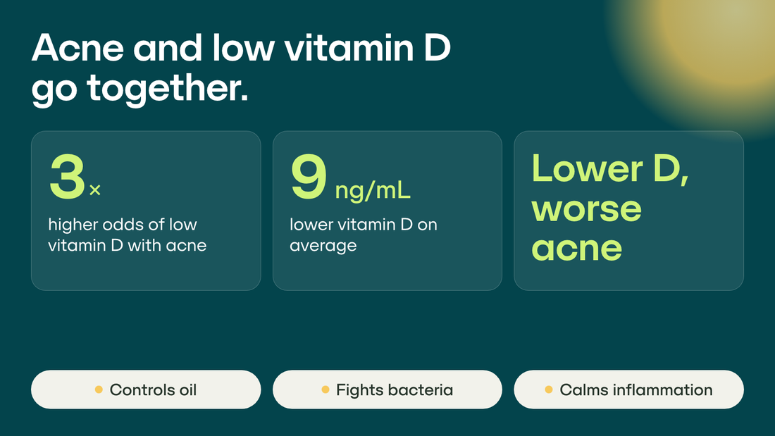 Infographic: people with acne have about 3 times higher odds of low vitamin D and about 9 ng/mL lower levels