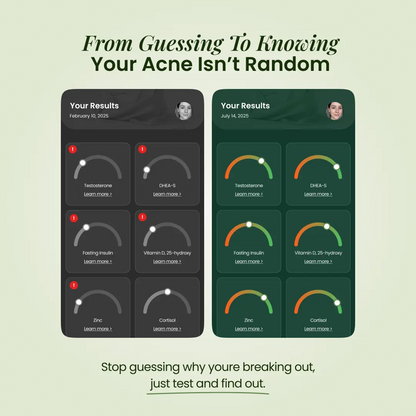 BreakoutLabs Acne Root Cause Test BreakoutLabs