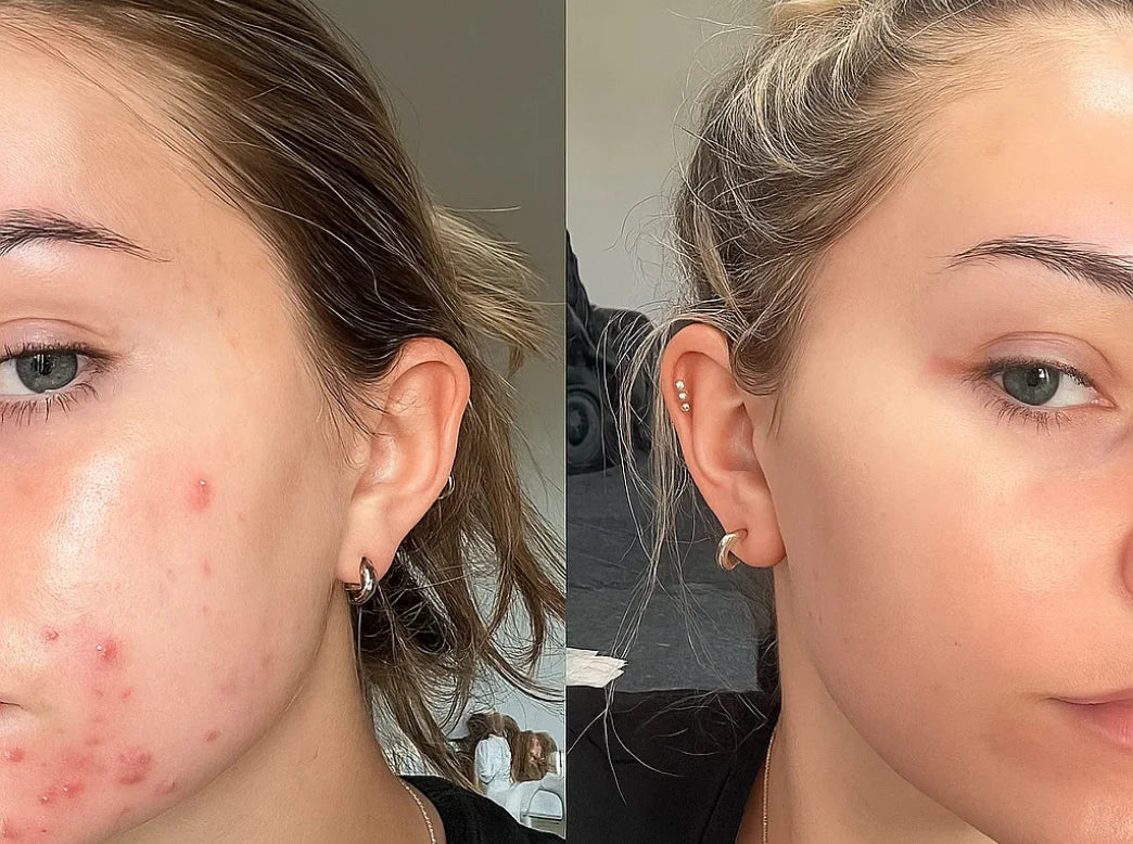 Megan B. before and after