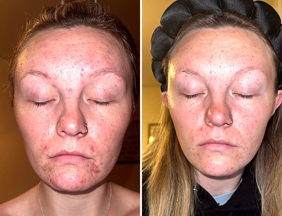 Jessica G. before and after
