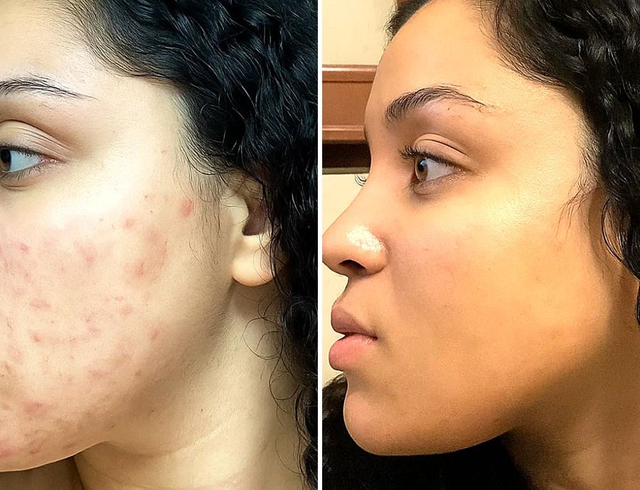 Jessica K. before and after