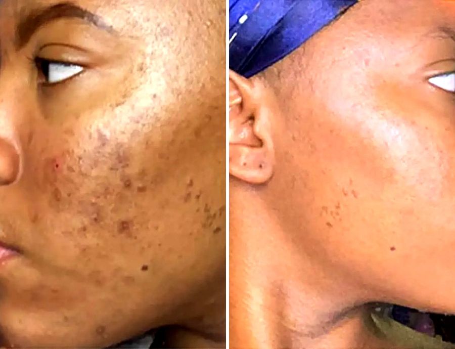 Nicole before and after